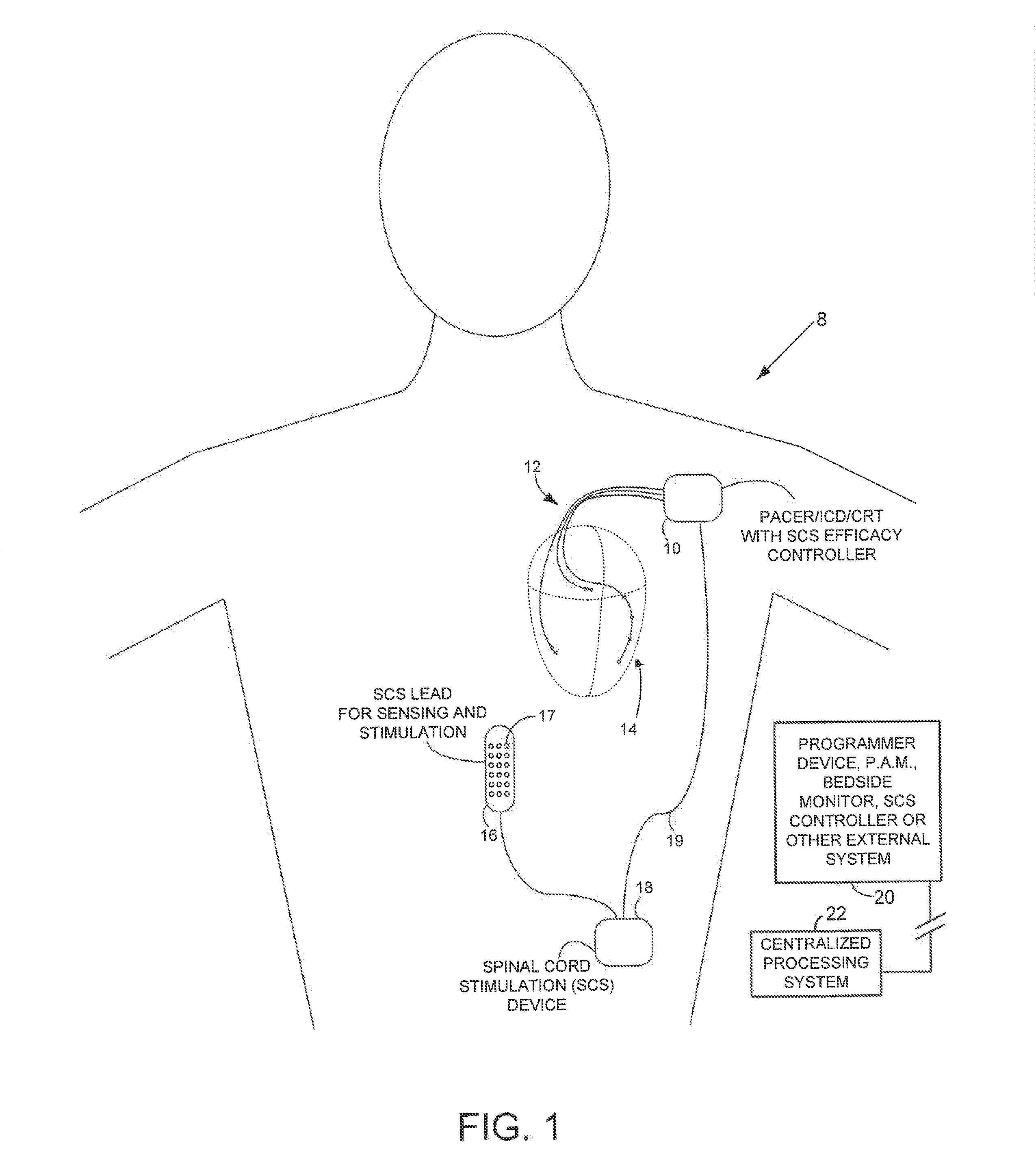 Systems and methods for controlling spinal cord stimulation to improve stimulation efficacy for use by implantable medical devices