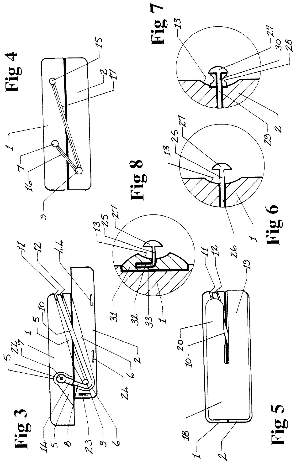 Mandibular advancement splint