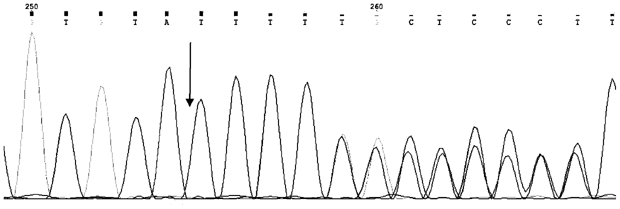 Mutation detection kit for vestibular aqueduct enlargement/Pendred syndrome virulence gene SLC26A4