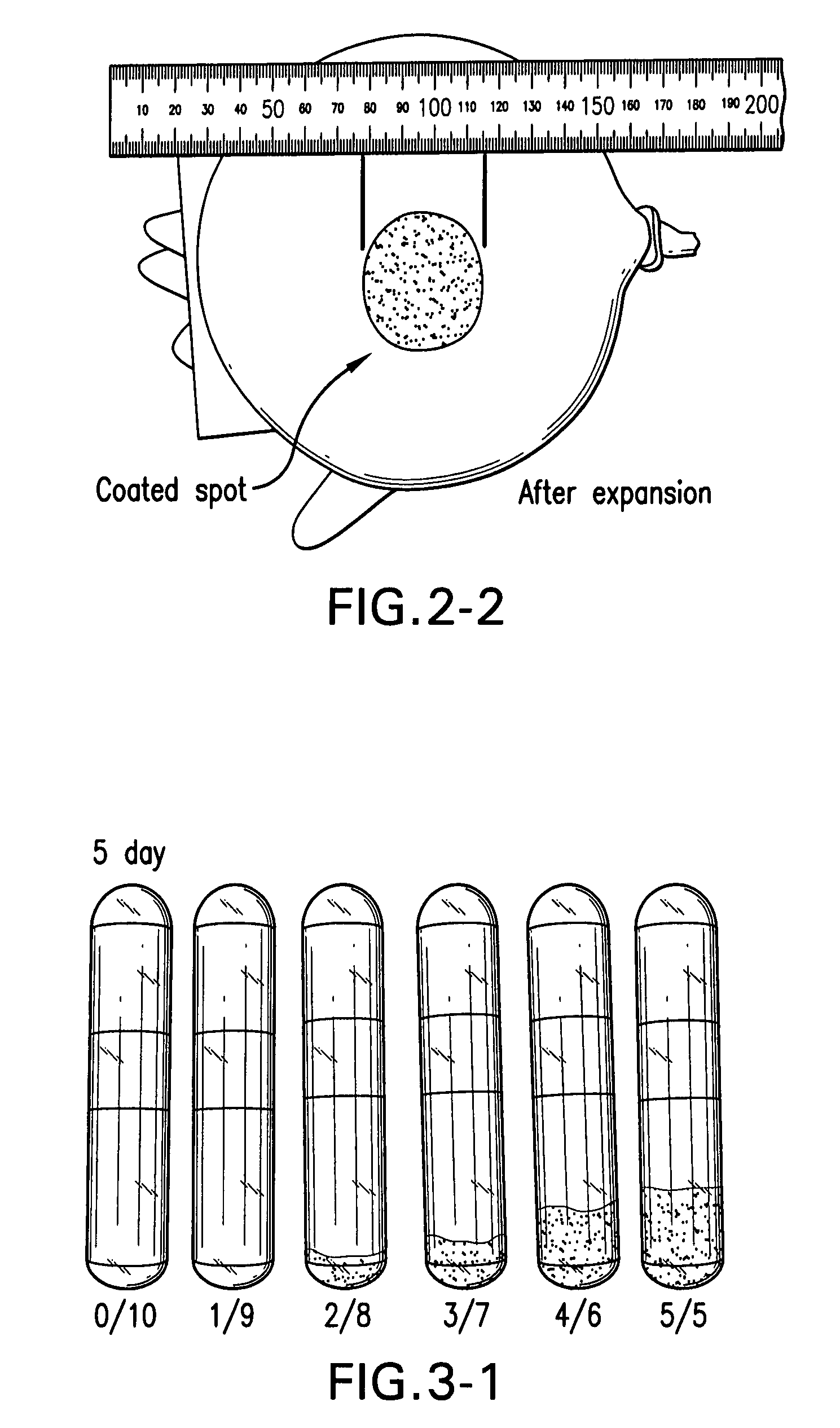 Medical-use two part reactive adhesive and medical-use resin having self-degradation property