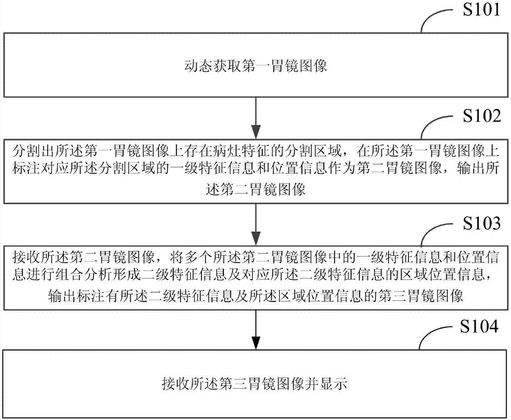 Gastroscope image intelligent processing method and device