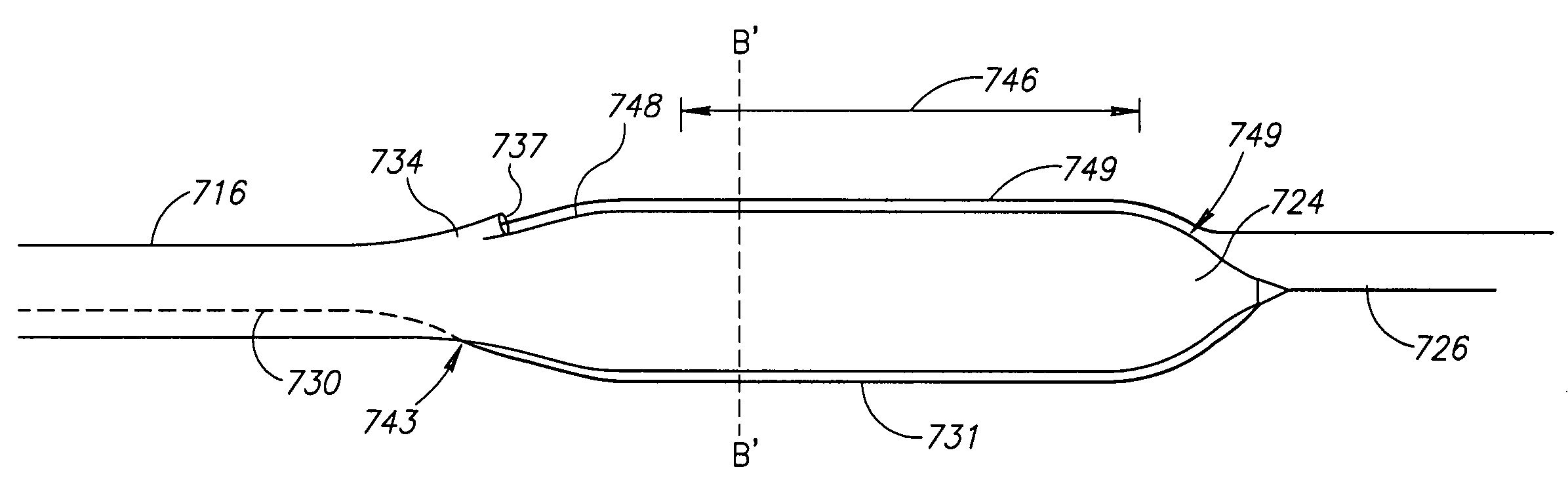 Vessel treatment devices