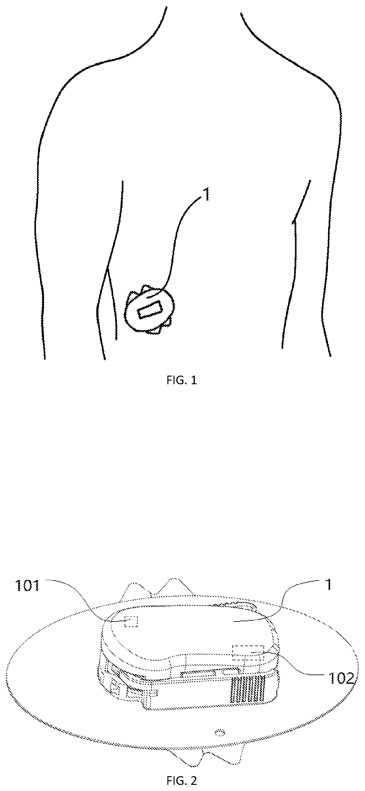 System and method for algorithm adjustment applying motions sensor in a CGM system