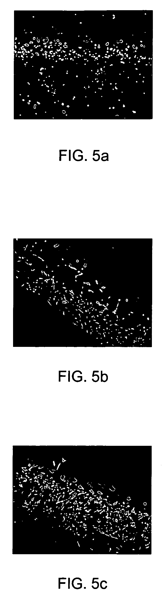 Medical devices comprising a reticulated composite material