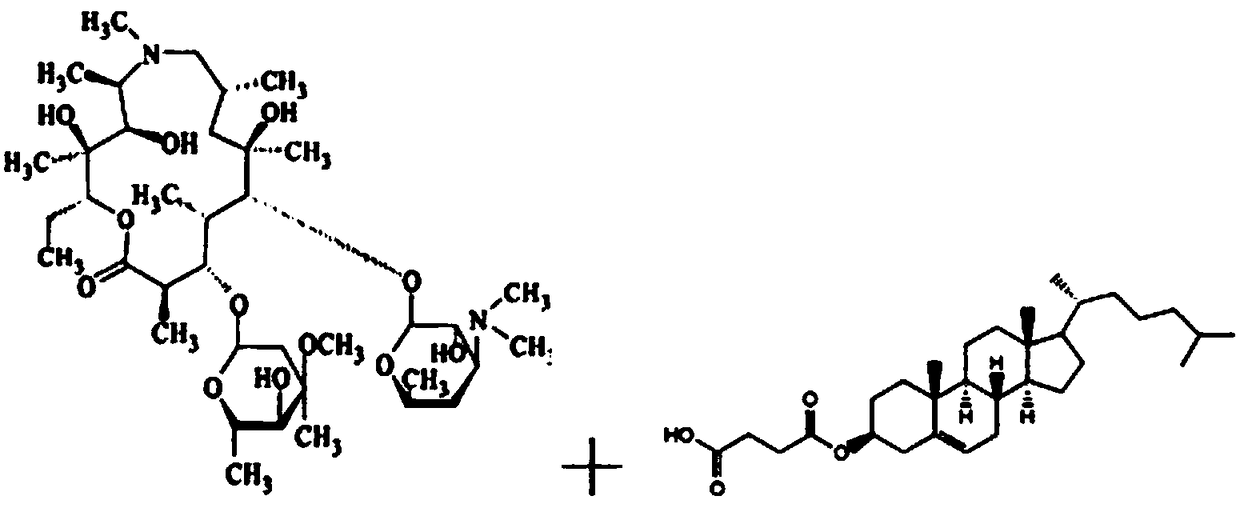 Azithromycin ion pair liposome eye drops and preparation method thereof