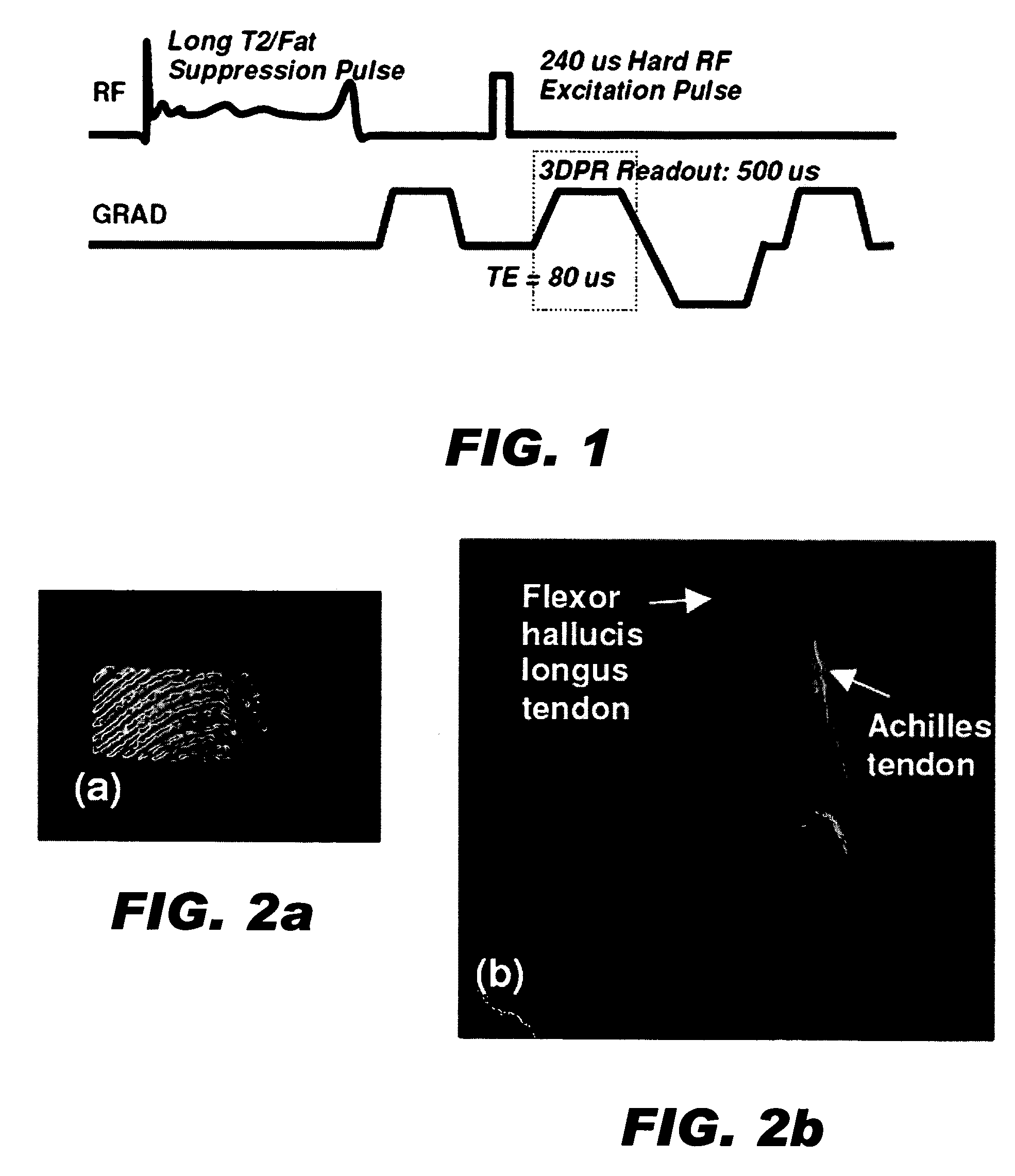 RF pulses for long T2 suppression in MRI