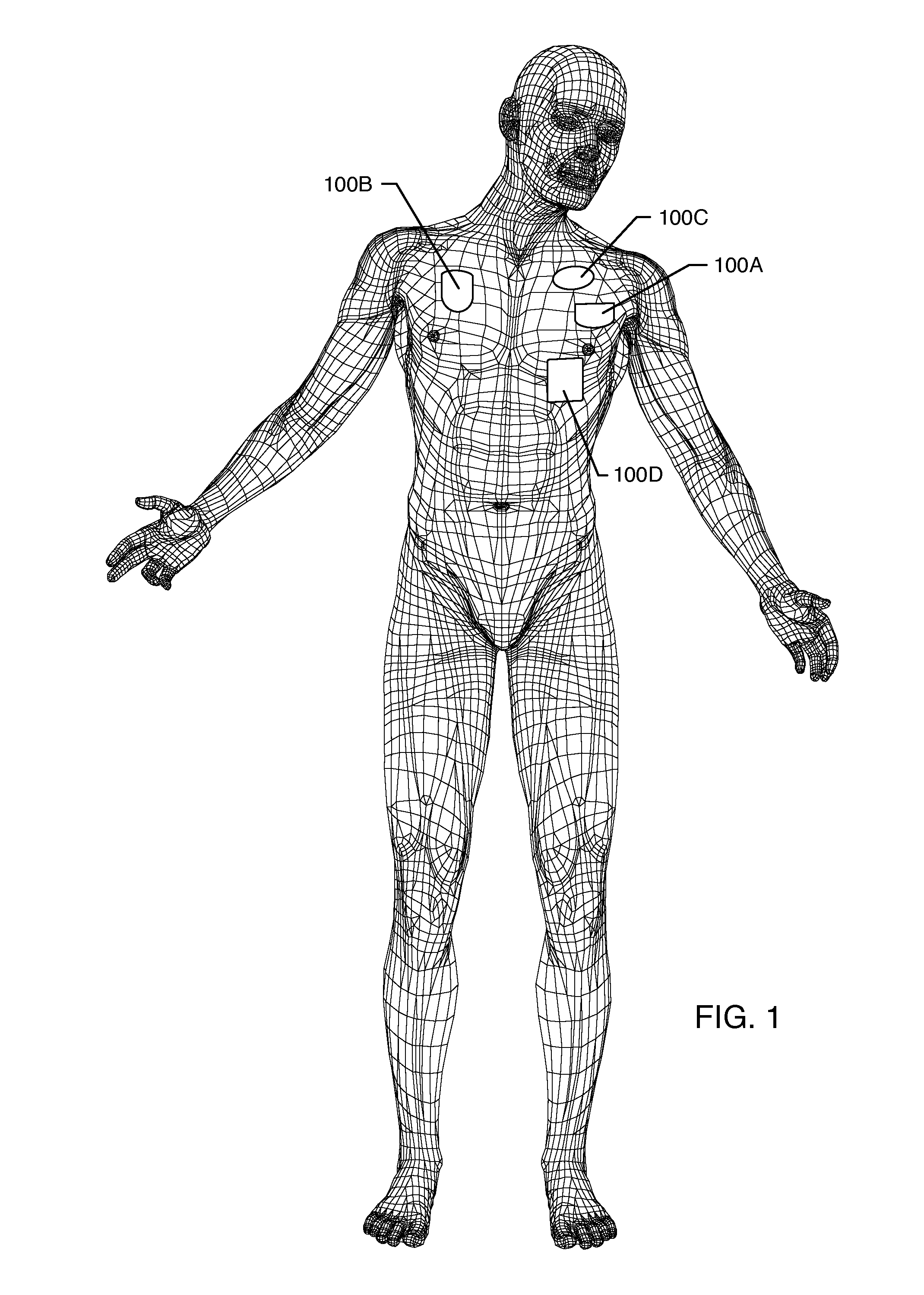 Secondary header for an implantable medical device incorporating an ISO DF4 connector and connector cavity and/or an IS4 connector and connector cavity