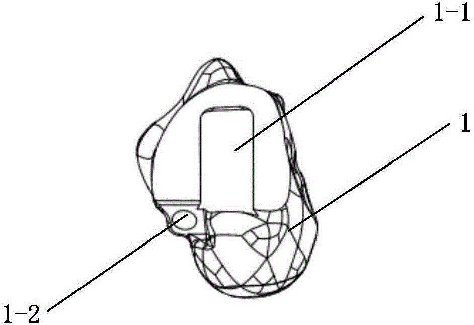 Detachable talus prosthesis