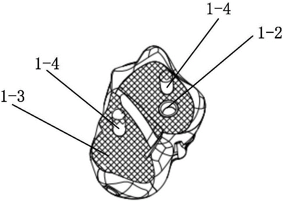 Detachable talus prosthesis