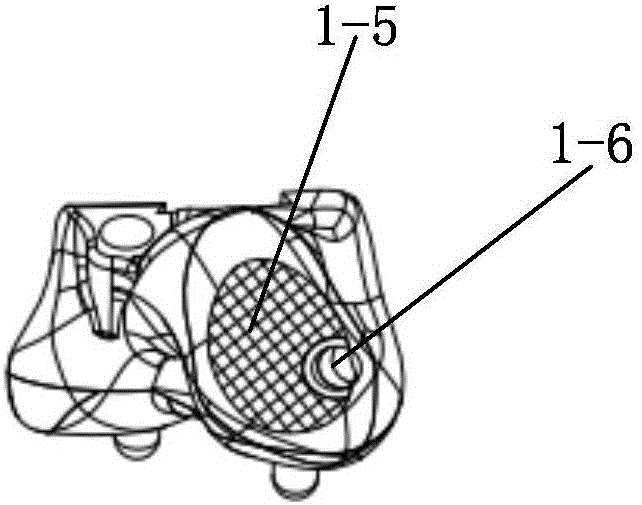 Detachable talus prosthesis