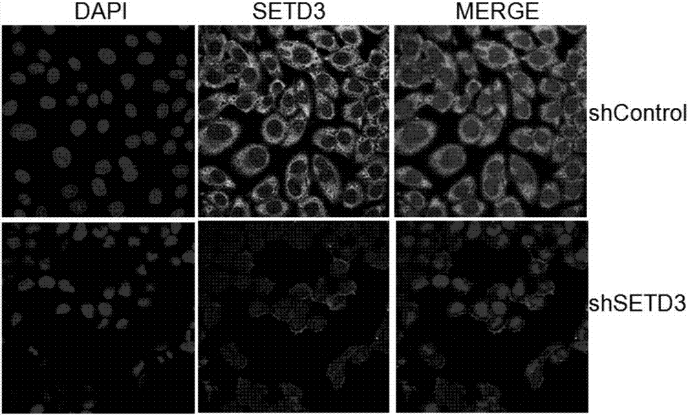 Preparation method of SETD3 antibody for immunofluorescence assay