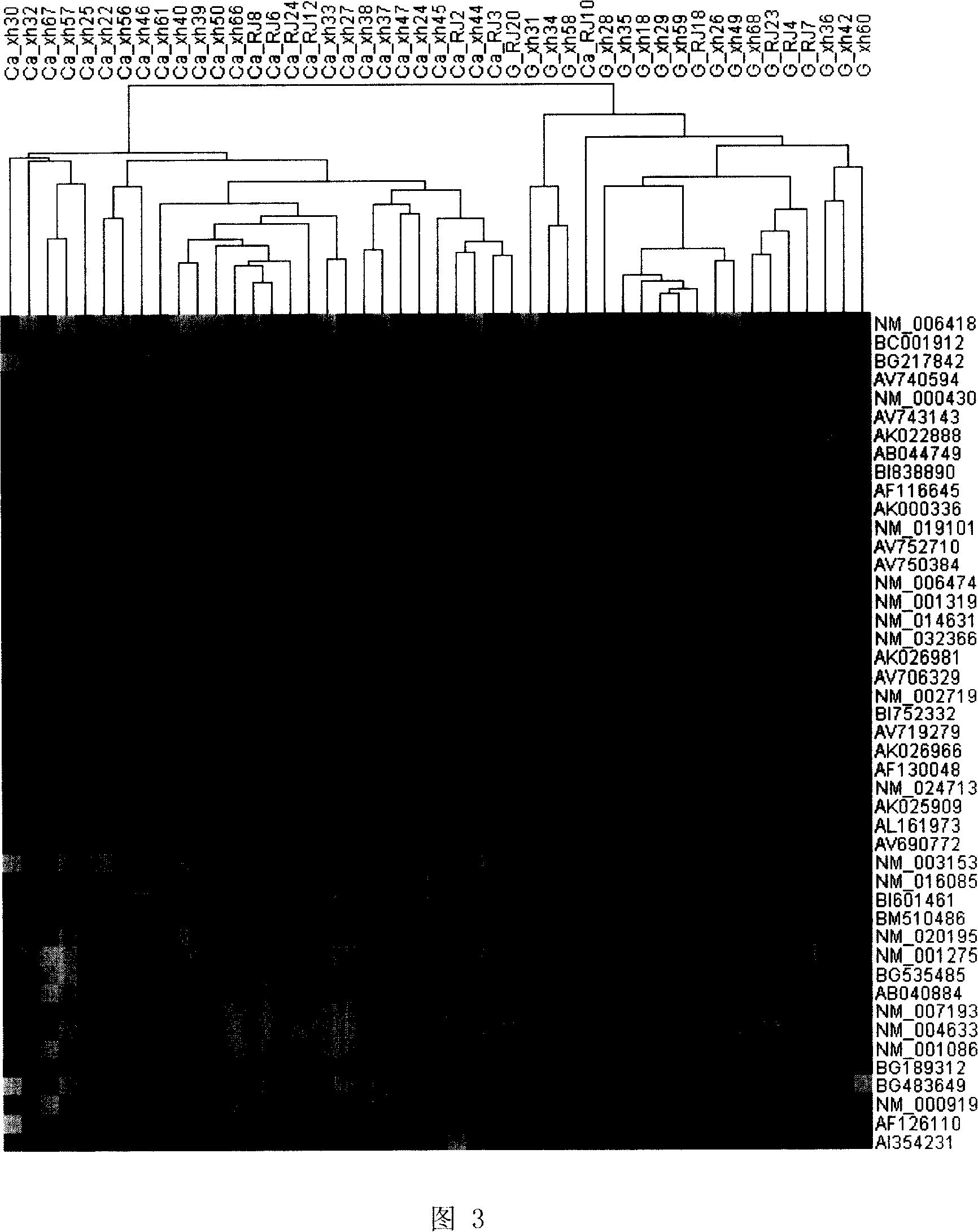 Gastric cancer auxiliary diagnosis gene order and application thereof