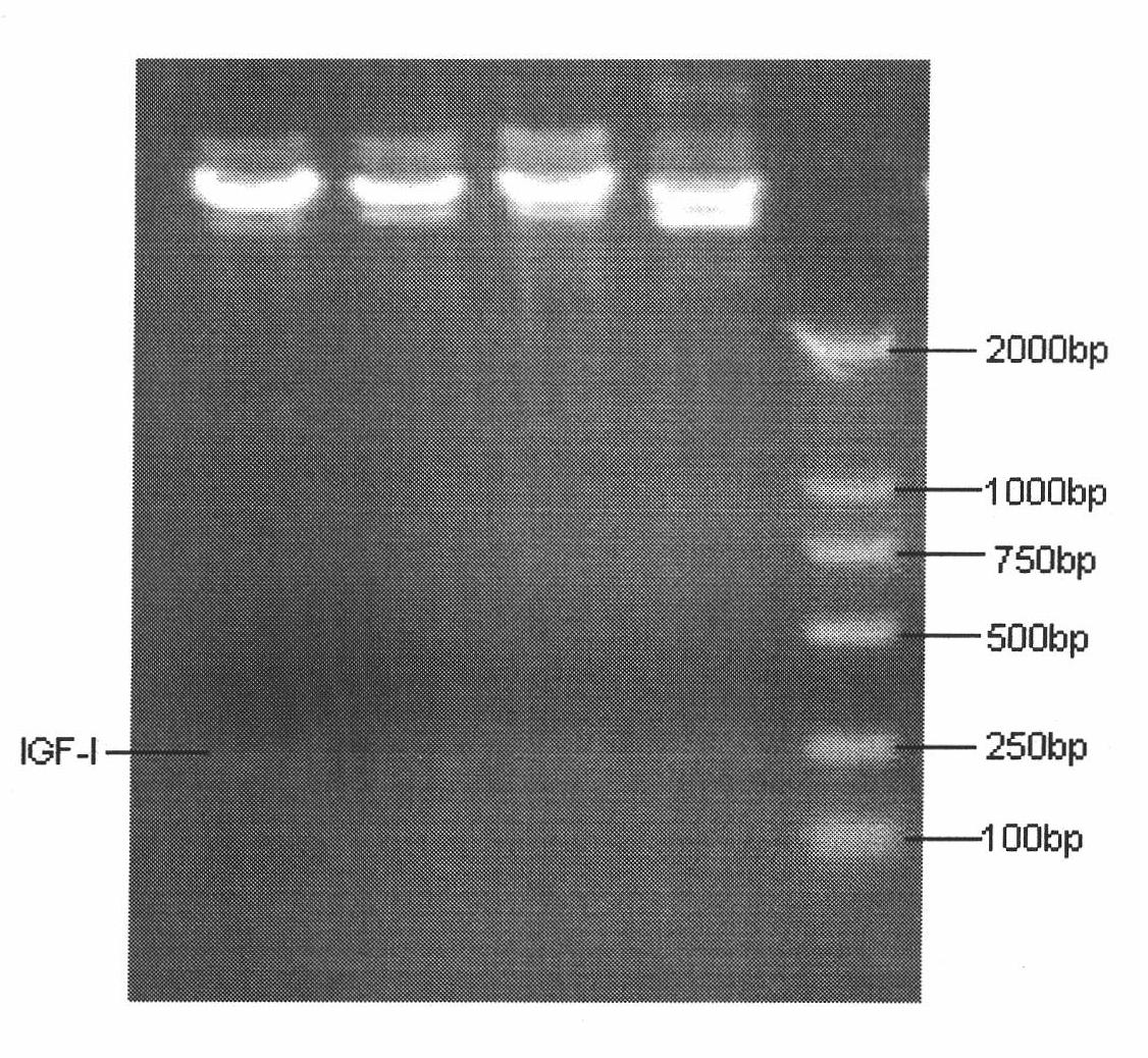 Construction and application of IRES (Internal Ribosome Entry Site) mediated four GH (Growth Hormone) subtypes and IGF-I (Insulin-like Growth Factor-I) bicistronic eukaryon co-expression vector