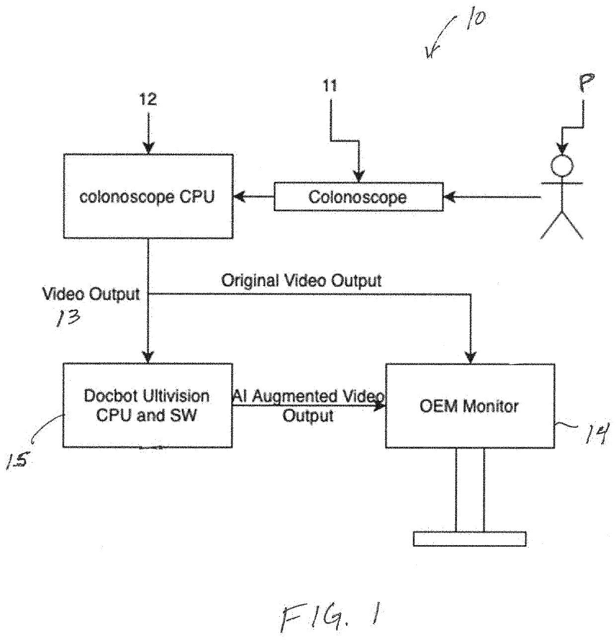 System and methods for aggregating features in video frames to improve accuracy of AI detection algorithms