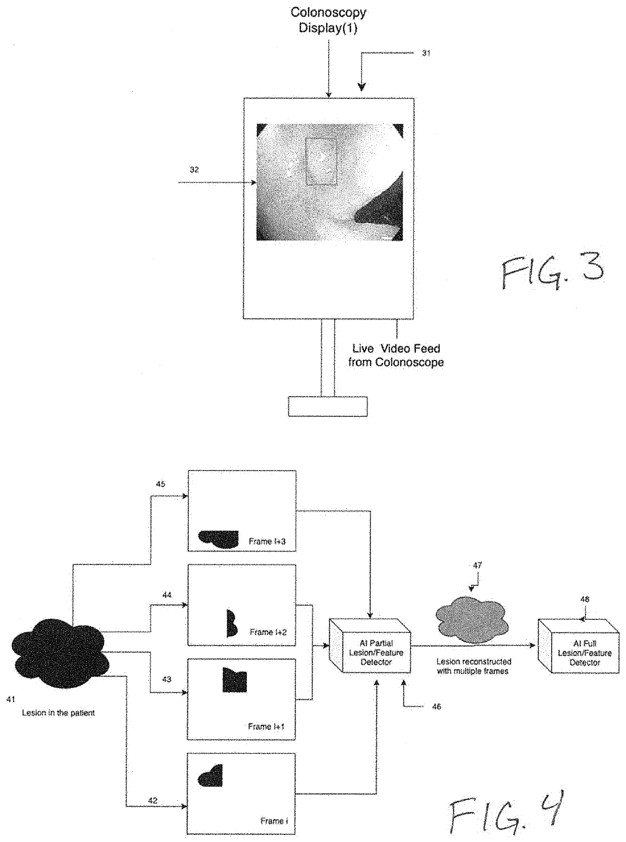 System and methods for aggregating features in video frames to improve accuracy of AI detection algorithms