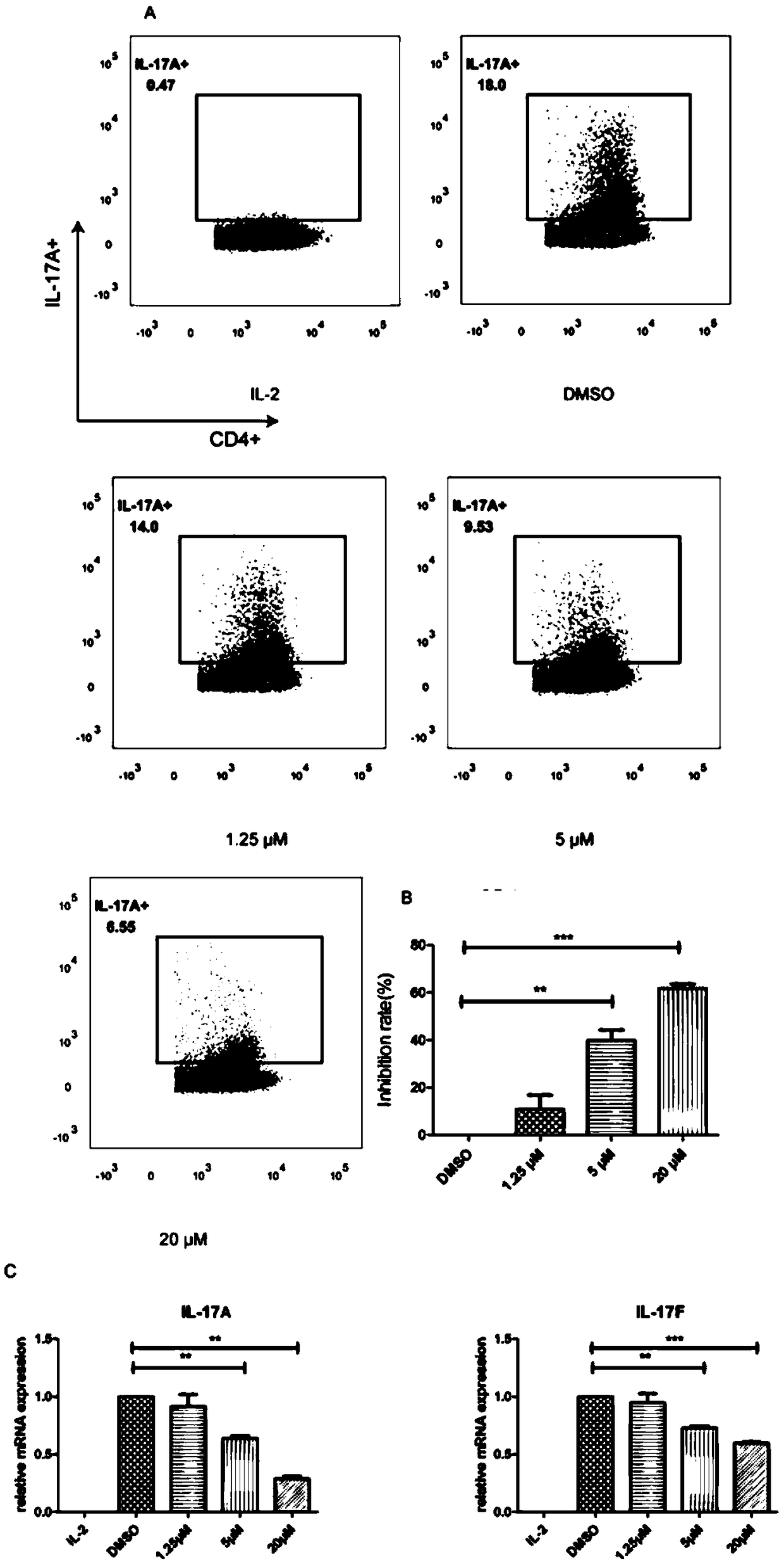 Application of oleanolic acid in preparation of drugs for treatment of autoimmune diseases