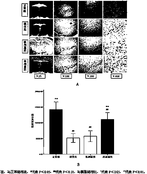 A kind of traditional Chinese medicine composition for treating Parkinson's disease