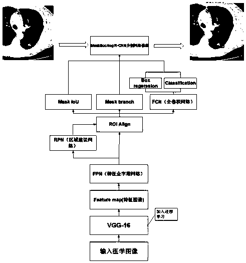 Migration learning lung lesion tissue detection system based on MaskScoring R-CNN network