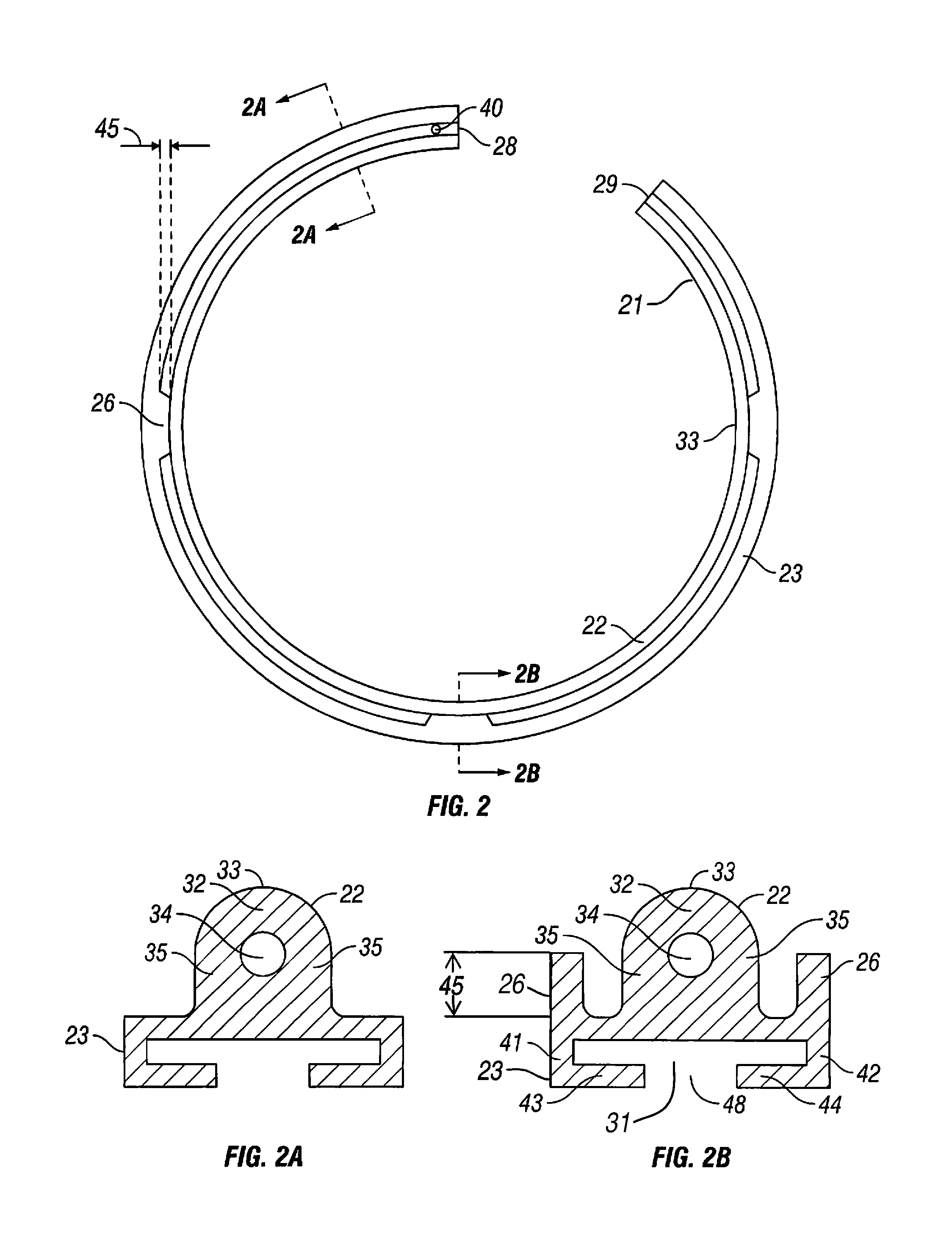 Compliant banding system