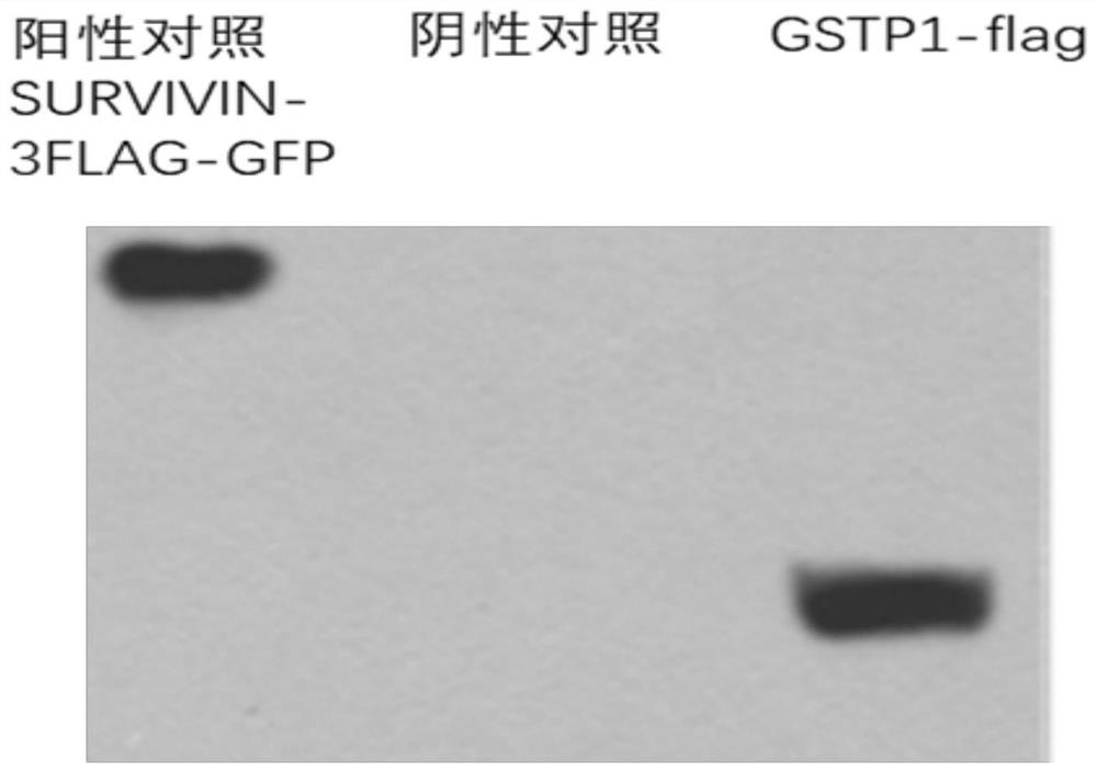 Application of excited GSTP1 gene in medicine for preventing radioactive lung injury