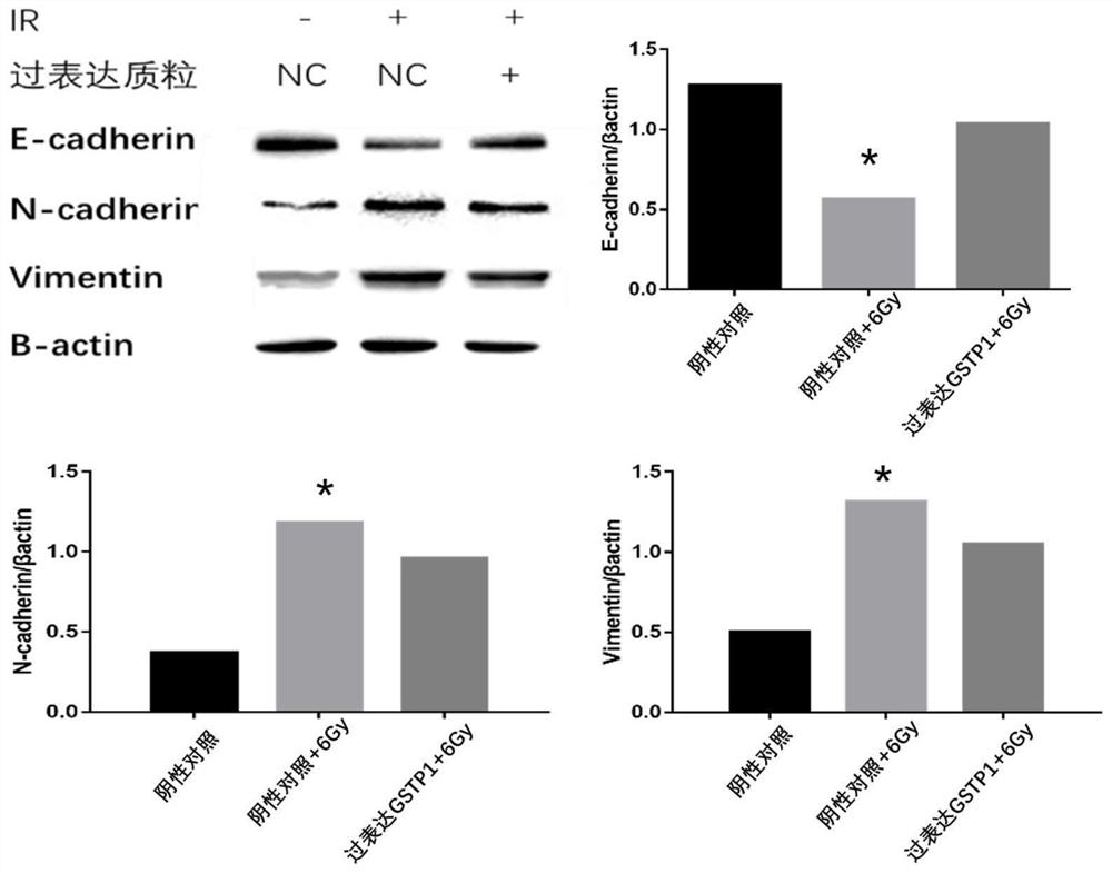 Application of excited GSTP1 gene in medicine for preventing radioactive lung injury