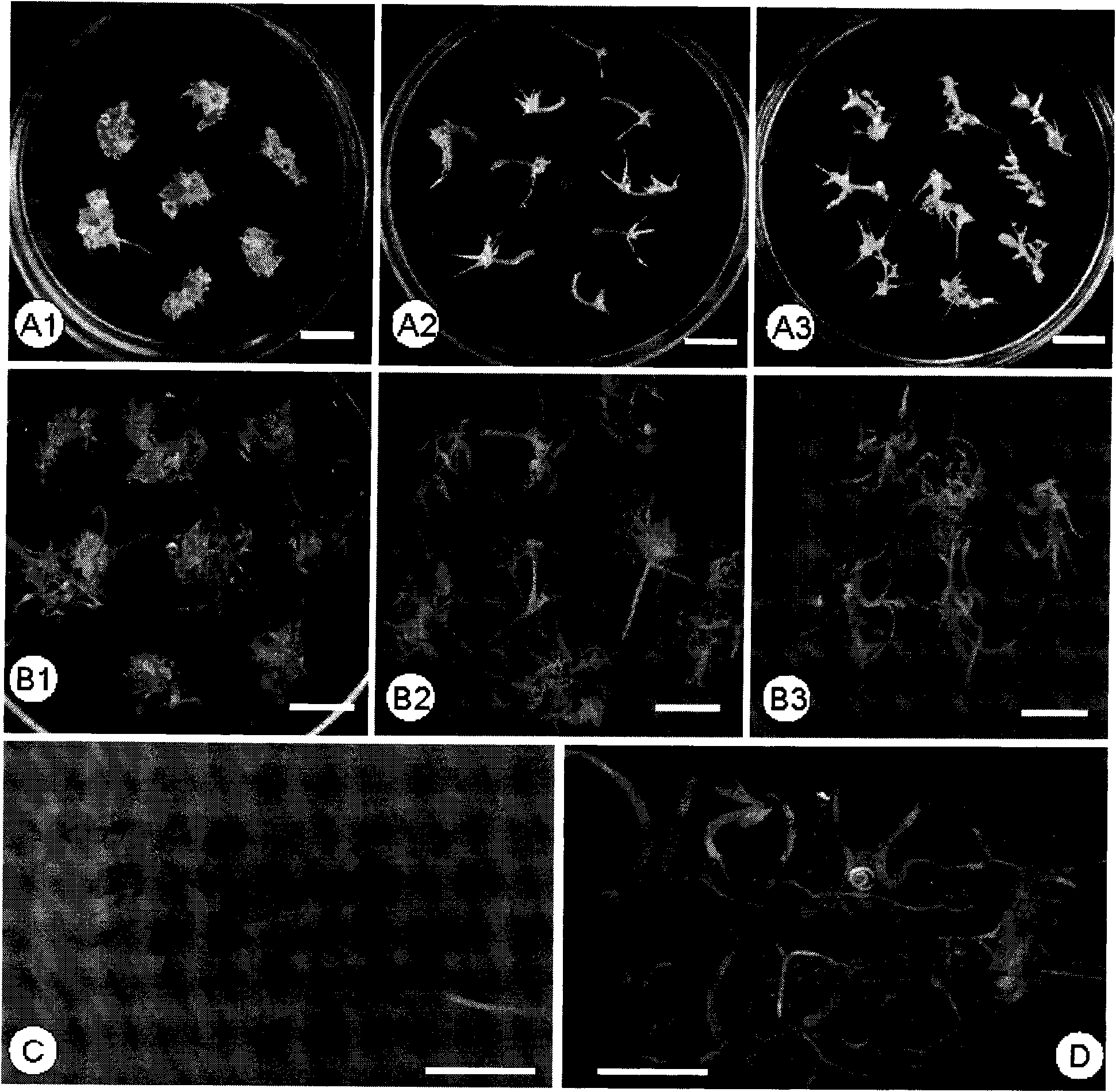 Method for rapidly propagating aralia elata through somatic embryo and secondary somatic embryogenesis