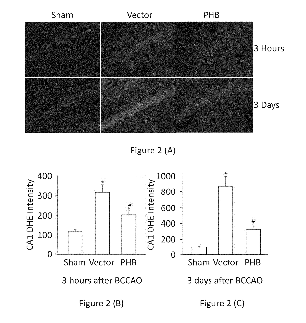 Gene therapy for Alzheimer's and other neurodegenerative diseases and conditions