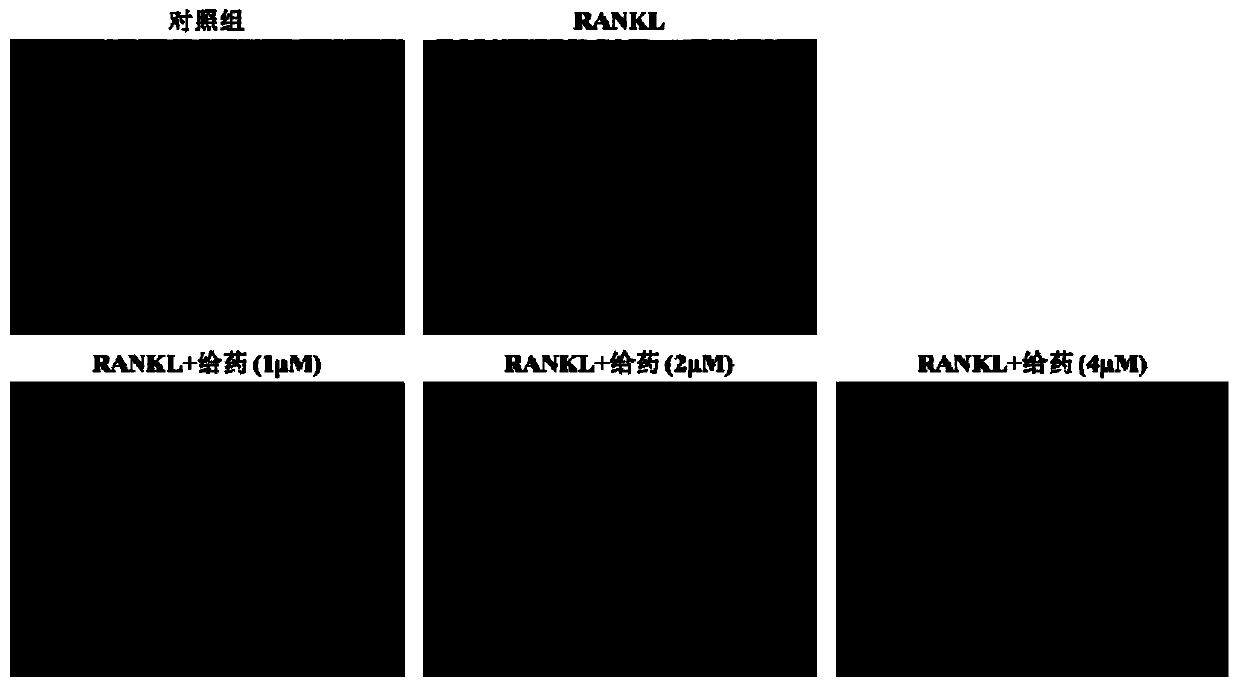 Application of a group of thiomatrine derivatives and their salts in the preparation of anti-osteoporosis drugs