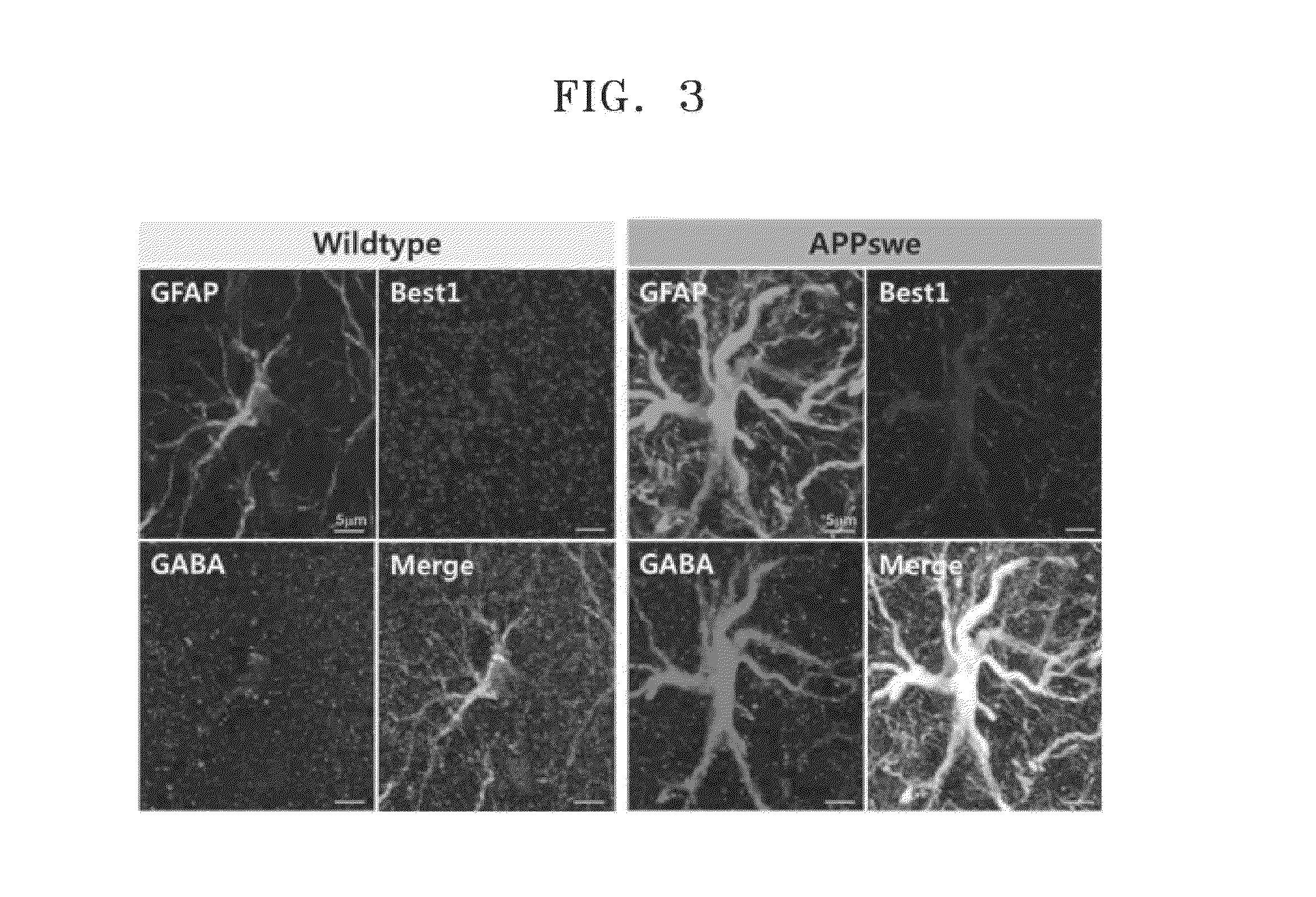 Pharmaceutical compositions for preventing or treating degenerative brain disease and method of screening the same