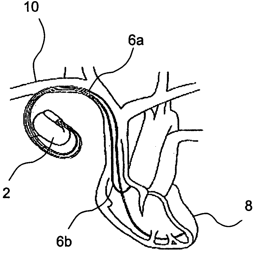 Method and implantable device for measuring hematocrit