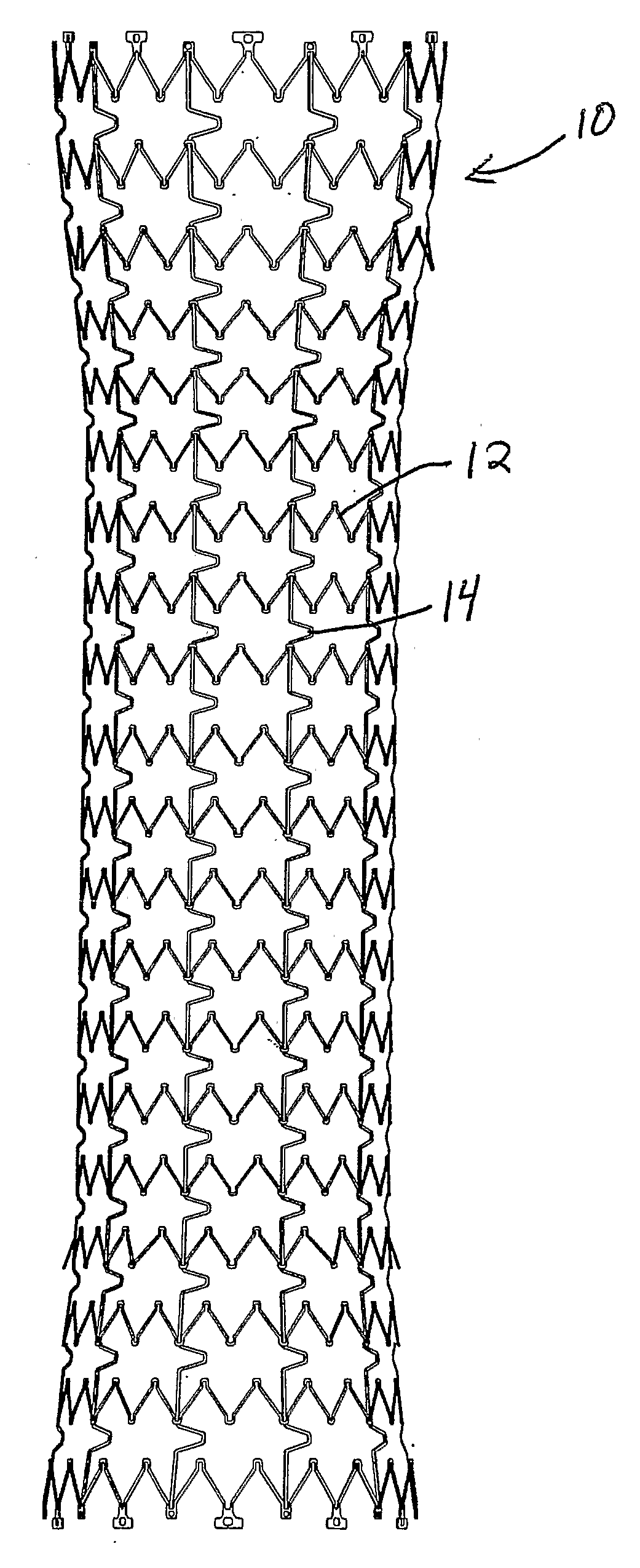 Stent Removal and Repositioning Aid and Associated Method