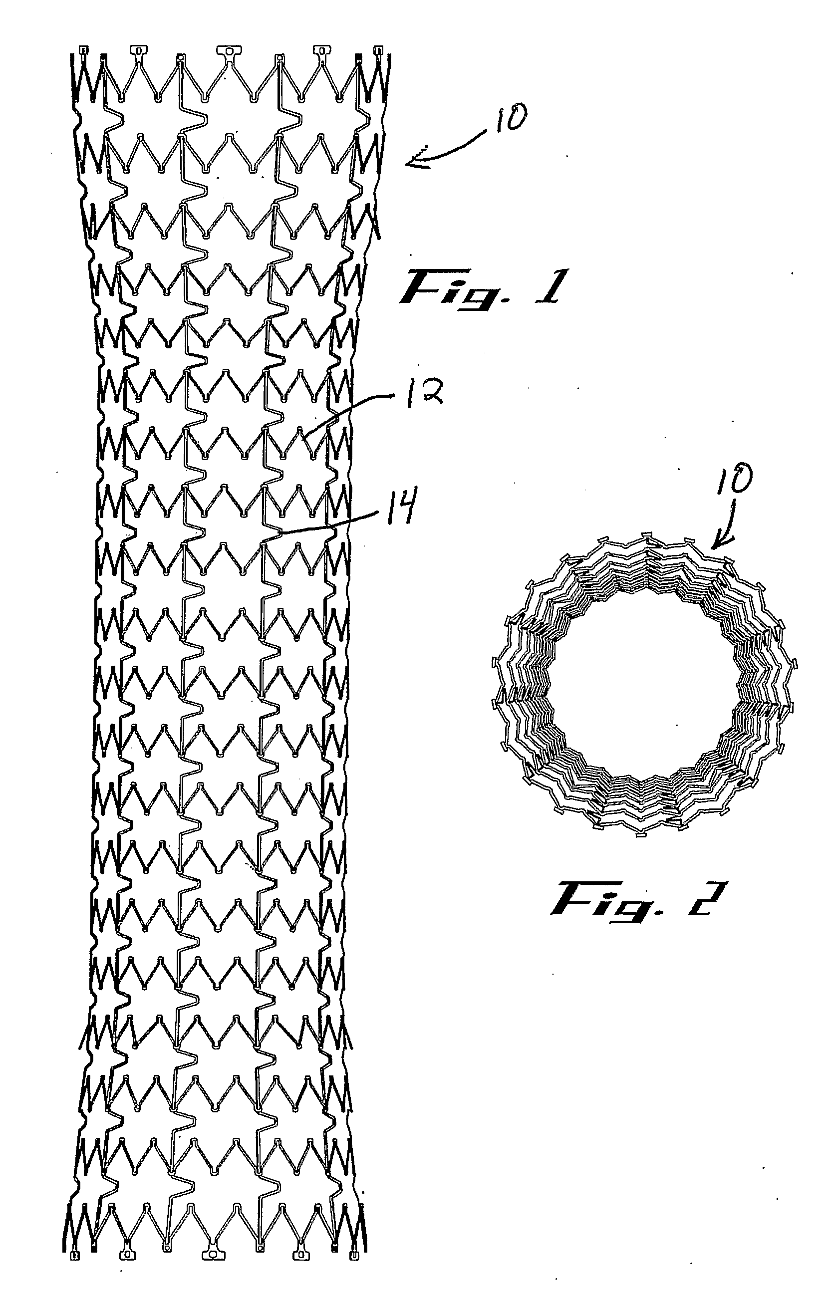 Stent Removal and Repositioning Aid and Associated Method