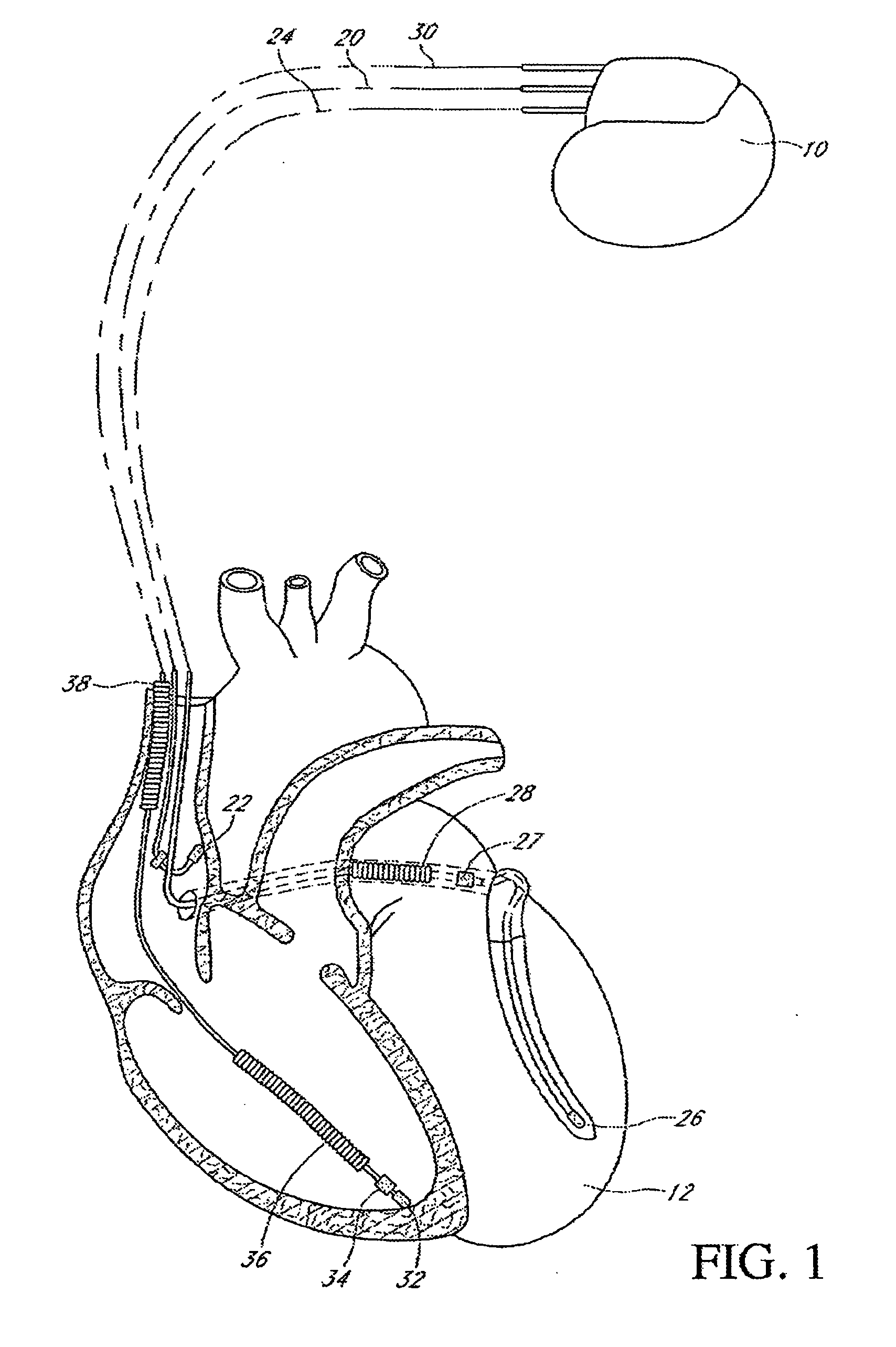 High Voltage Confirmation System Utilizing Impedance Data