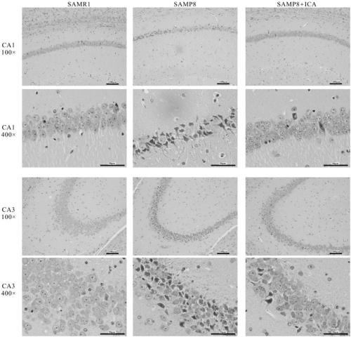 Application of icariin in preparation of medicine for preventing and treating Alzheimer's disease