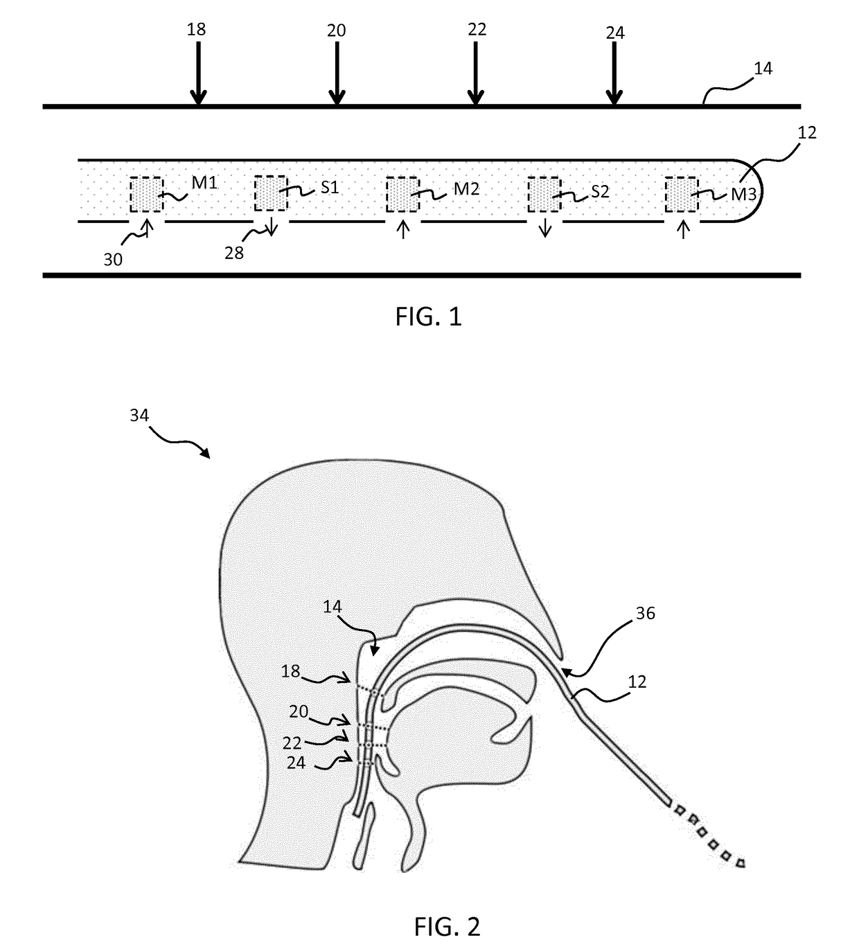 Catheter device