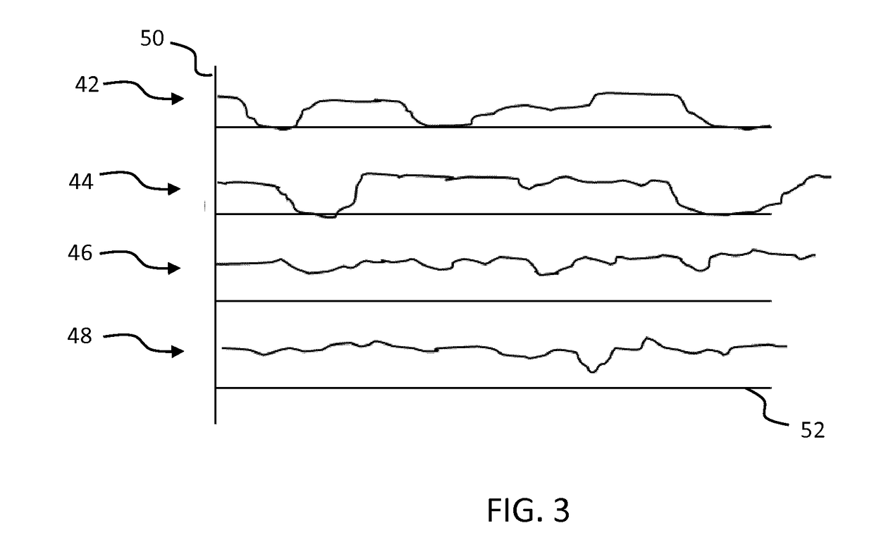 Catheter device