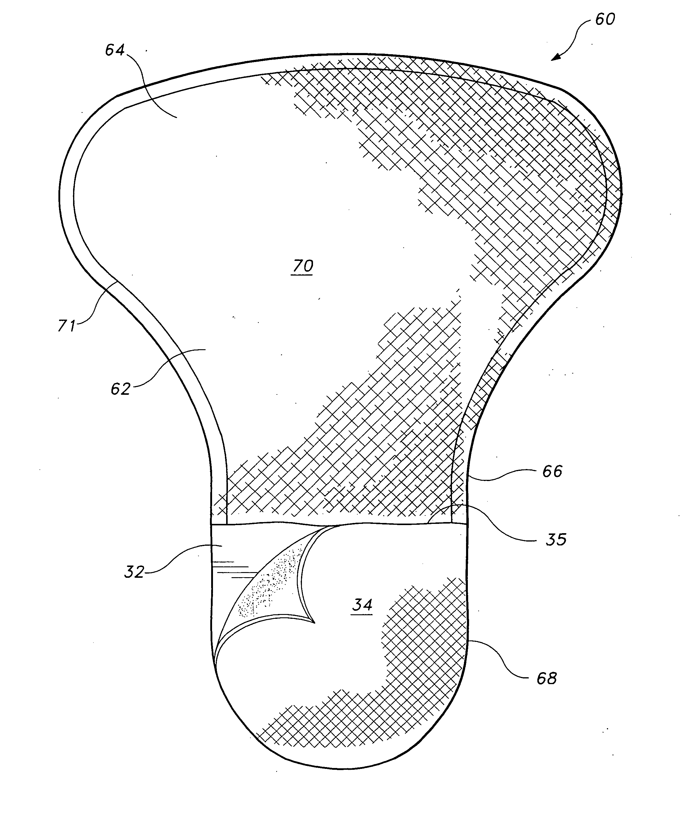 Disposable incontinence napkin for men