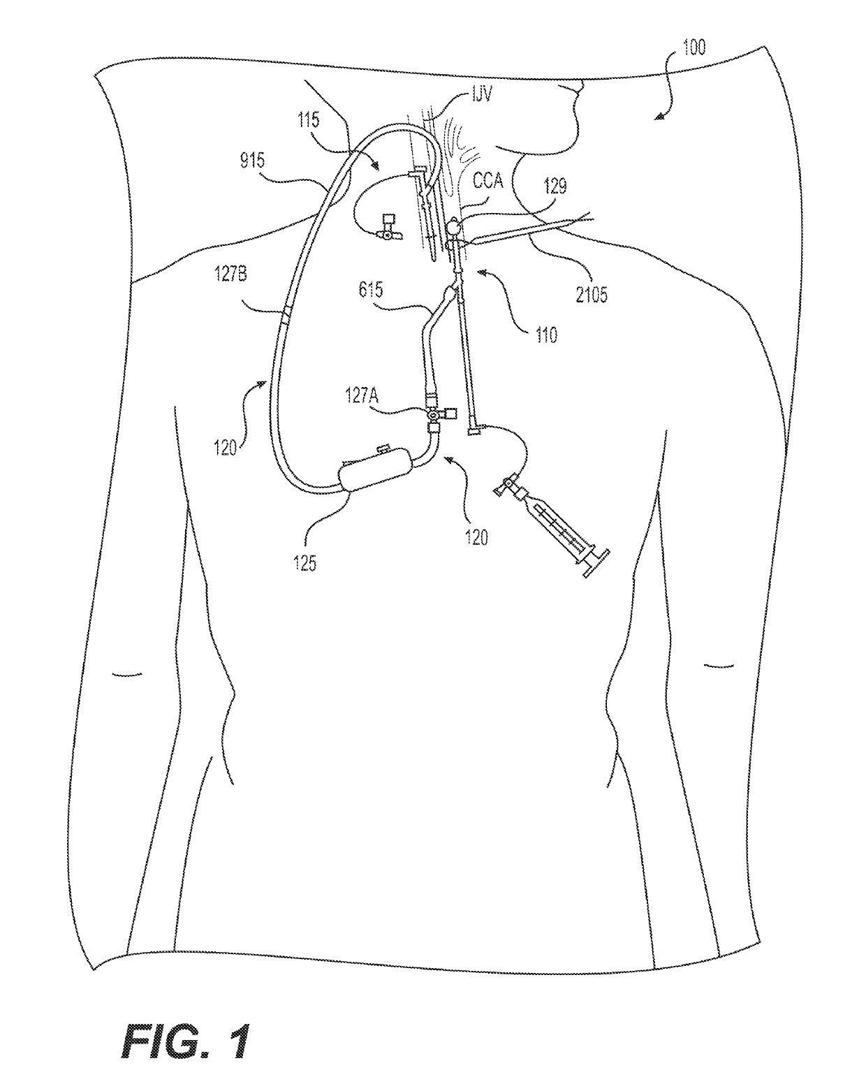 Systems and methods for treating eye diseases