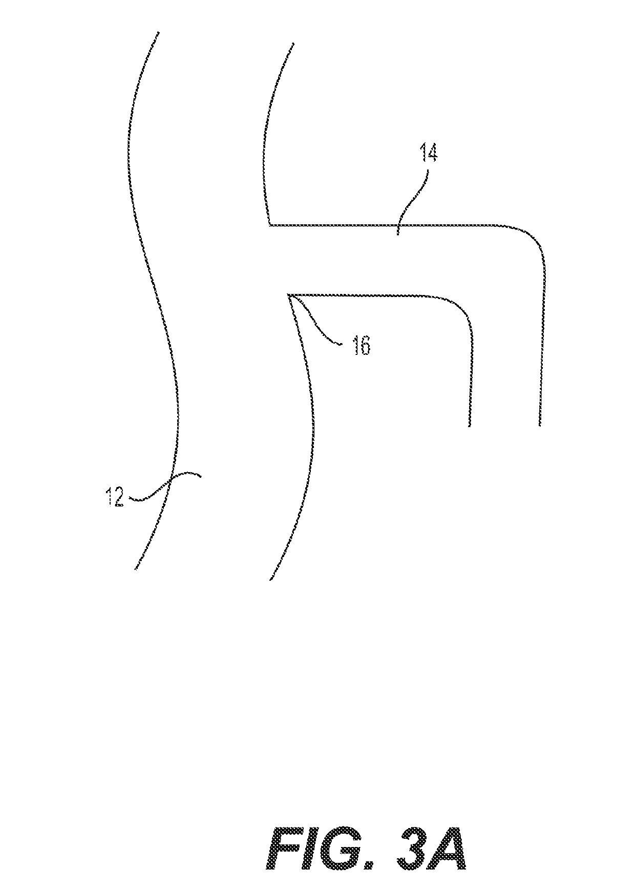 Systems and methods for treating eye diseases