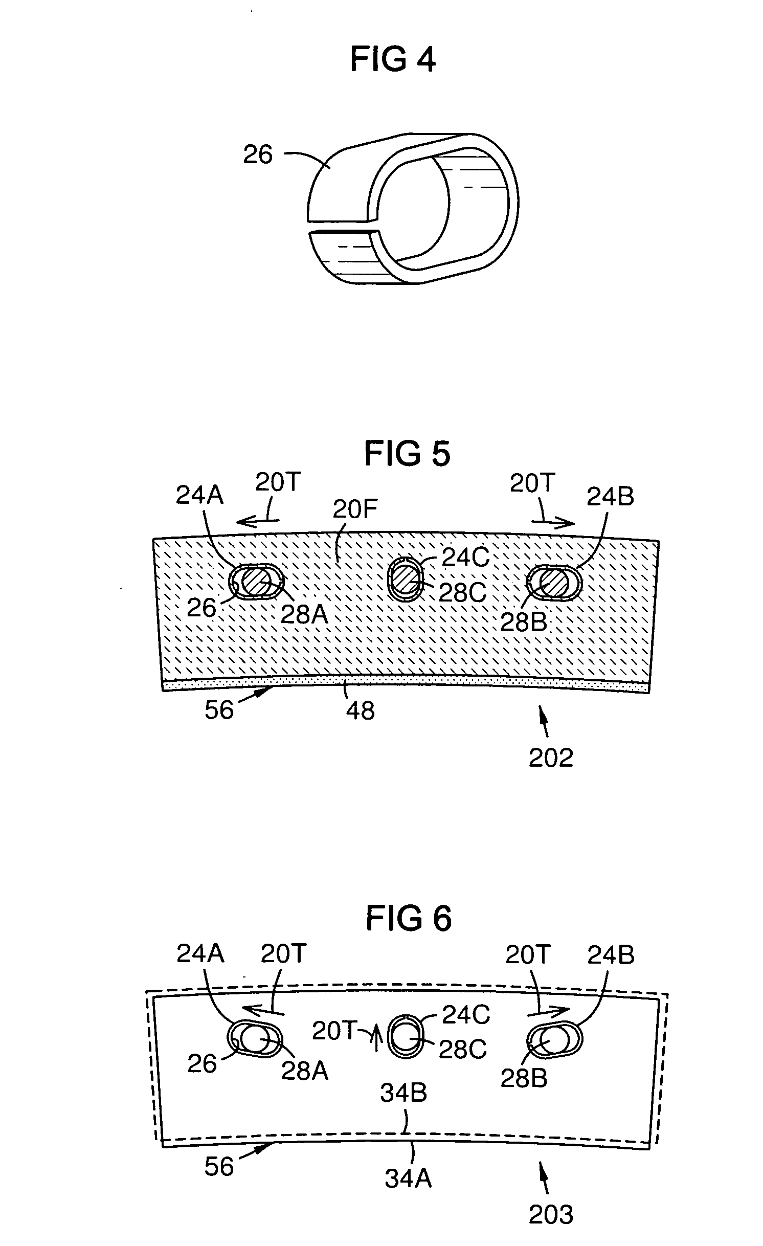 CMC to metal attachment mechanism