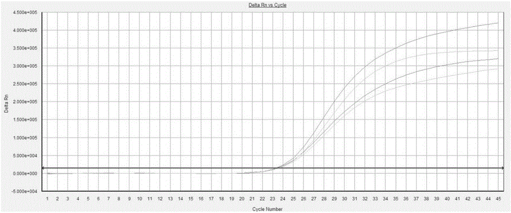 Multi-fluorescent PCR (polymerase chain reaction) detection kit for periodontitis pathogenic bacteria