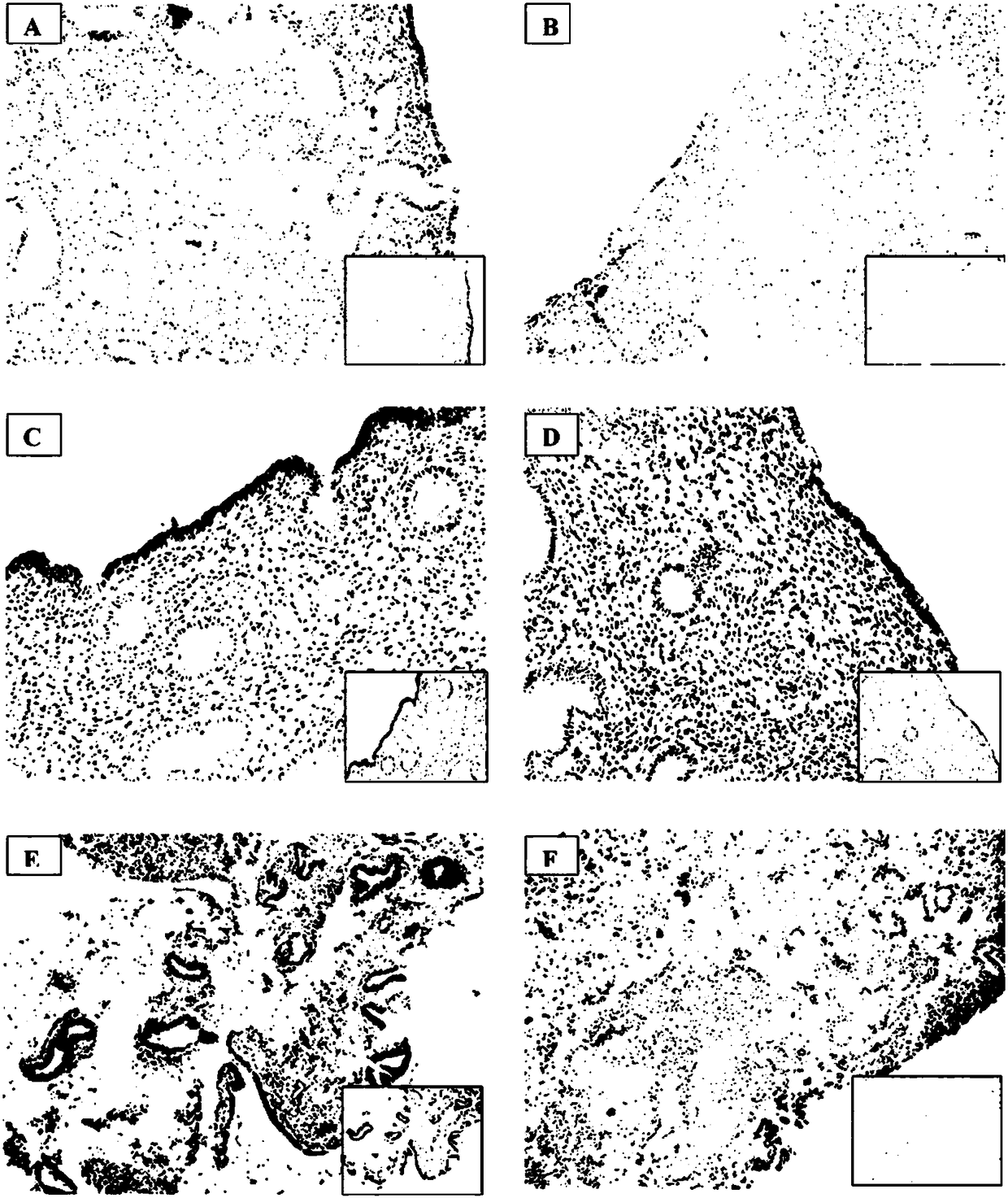 Method of treatment and prognosis