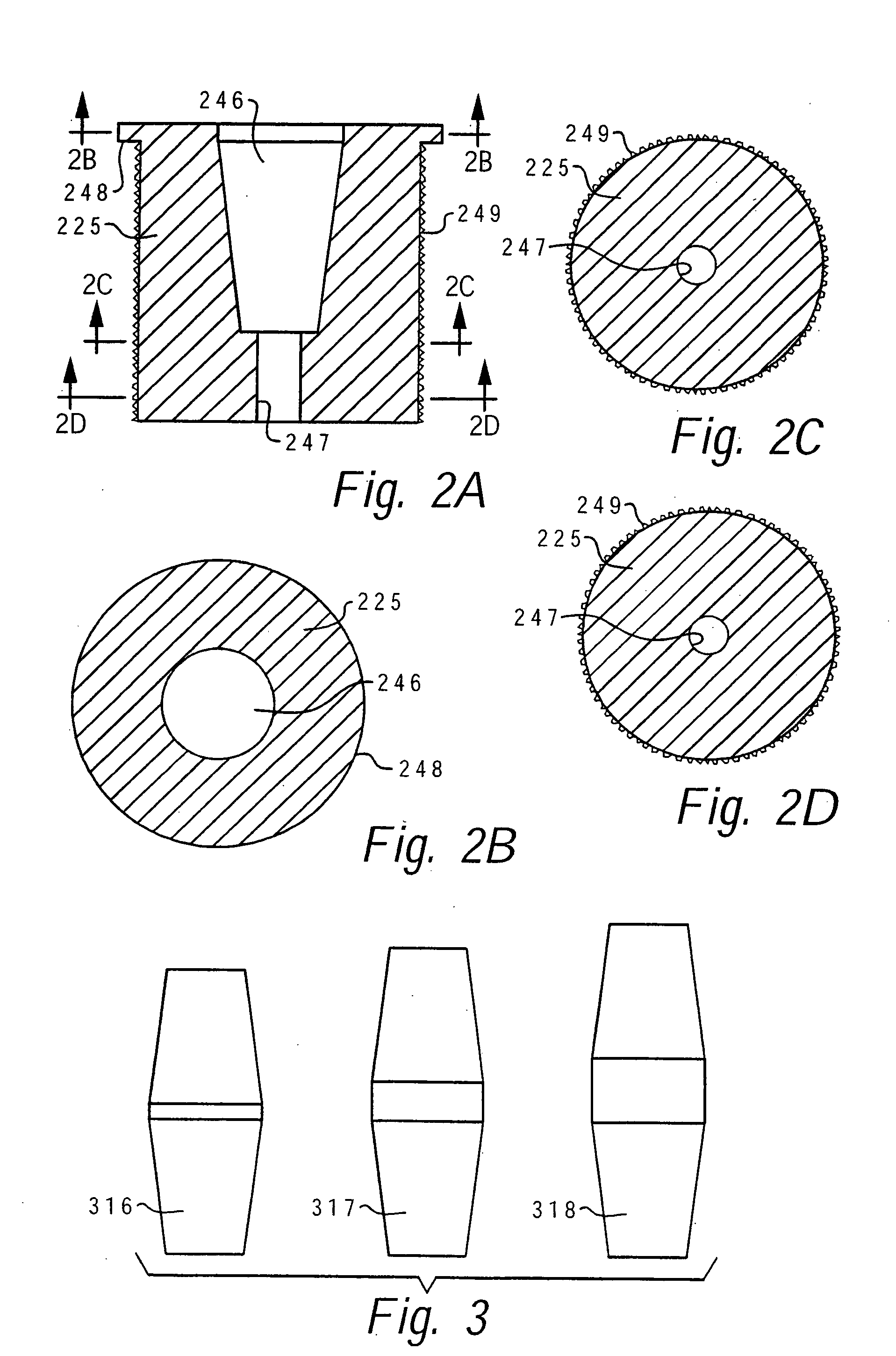 Method of implanting a femoral neck fixation prosthesis