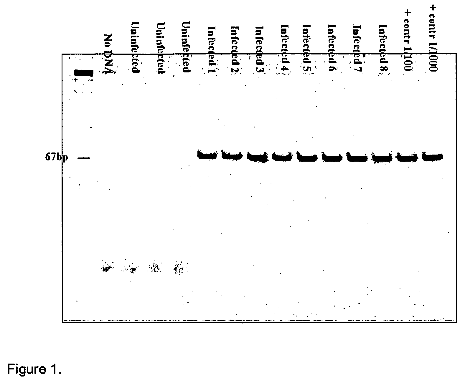 Kits for diagnosis and monitoring of pathogenic infection by analysis of cell-free pathogenic nucleic acids in urine