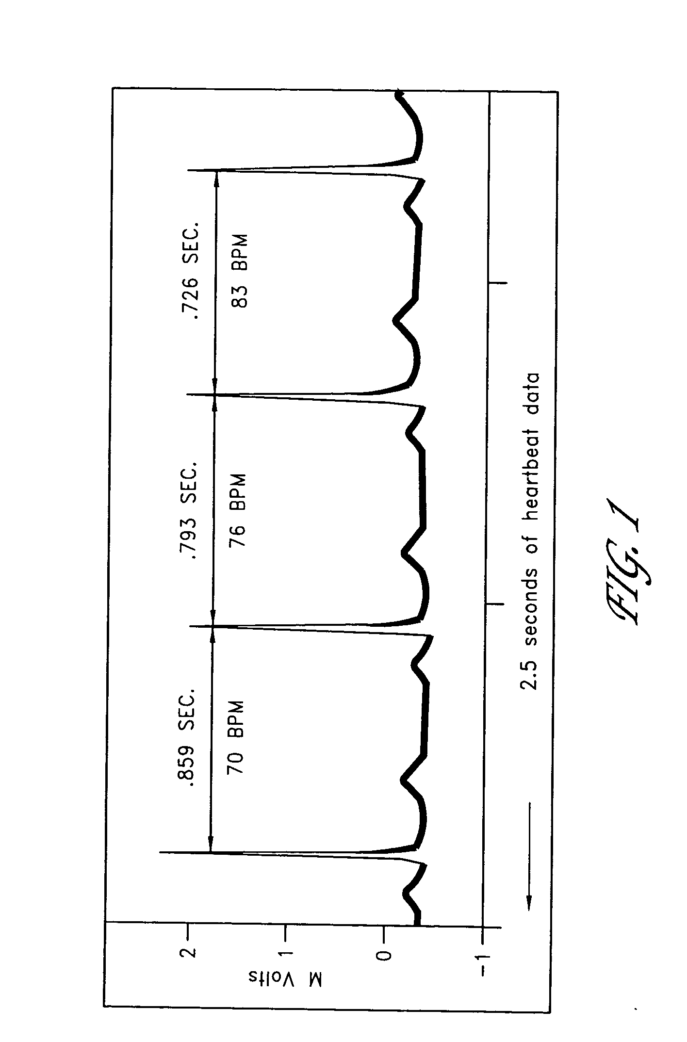 System and method for isolating effects of basal autonomic nervous system activity on heart rate variability