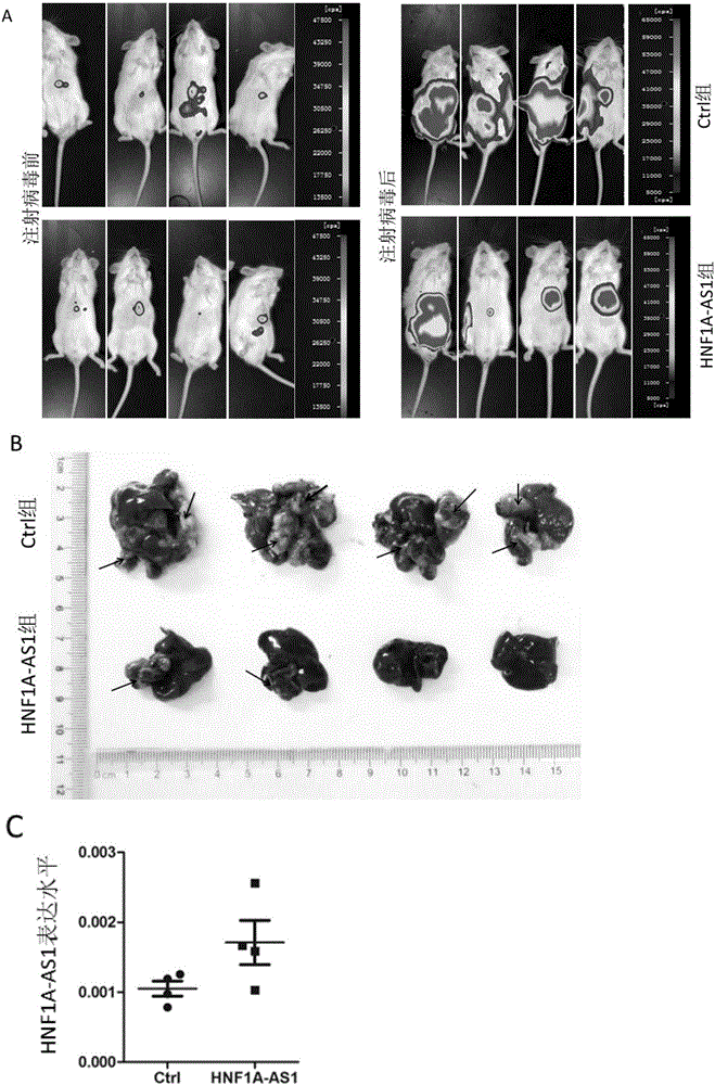 Application of long noncoding RNA HNF1A-AS1 ((hepatocyte nuclear factor-1Alpha Antisense 1) in preparation of drugs for treating human malignant solid tumors