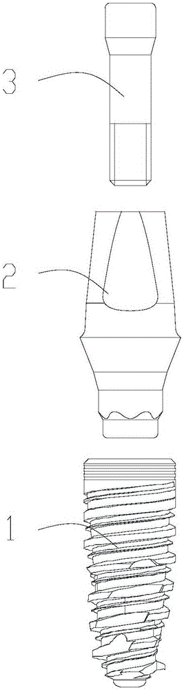 Straight abutment implant system based on titanium zirconium alloy