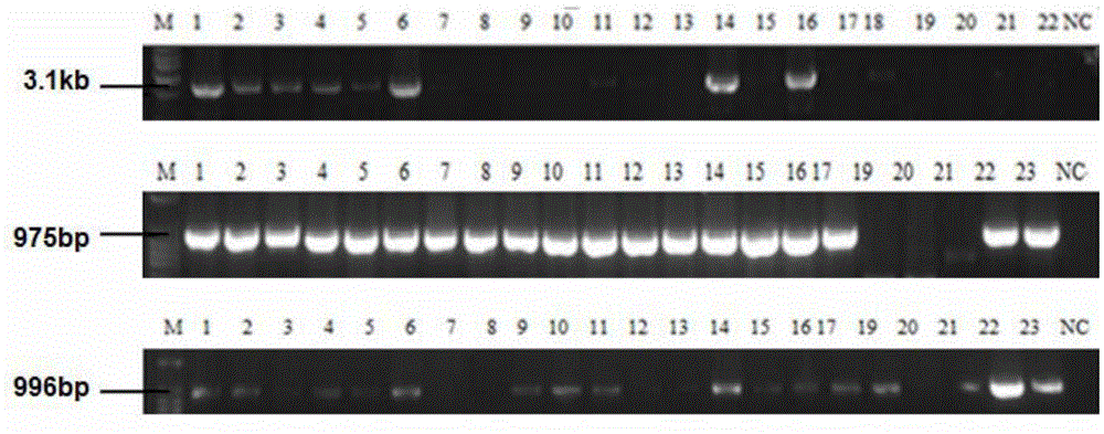 Method for utilizing human butyrylcholinesterase minigene to express recombinant human butyrylcholinesterase in mammary gland