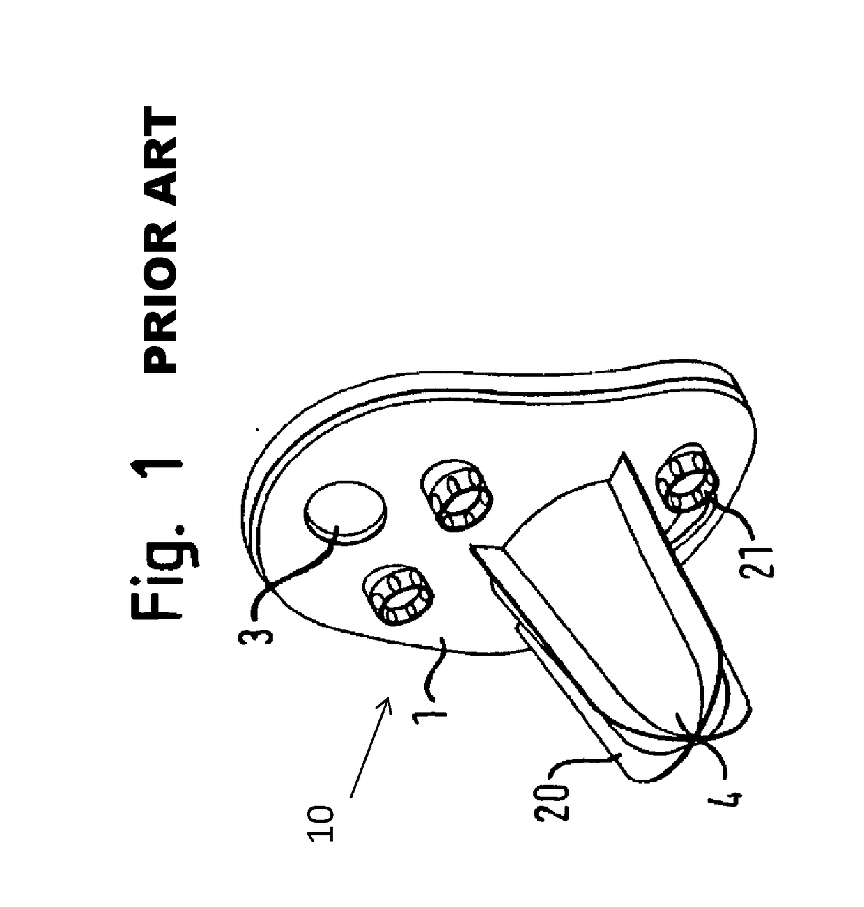 Improved glenoid anchor for a shoulder joint prosthesis