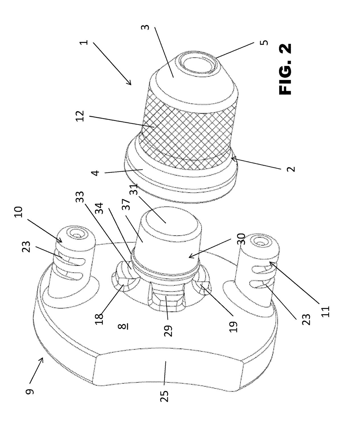 Improved glenoid anchor for a shoulder joint prosthesis